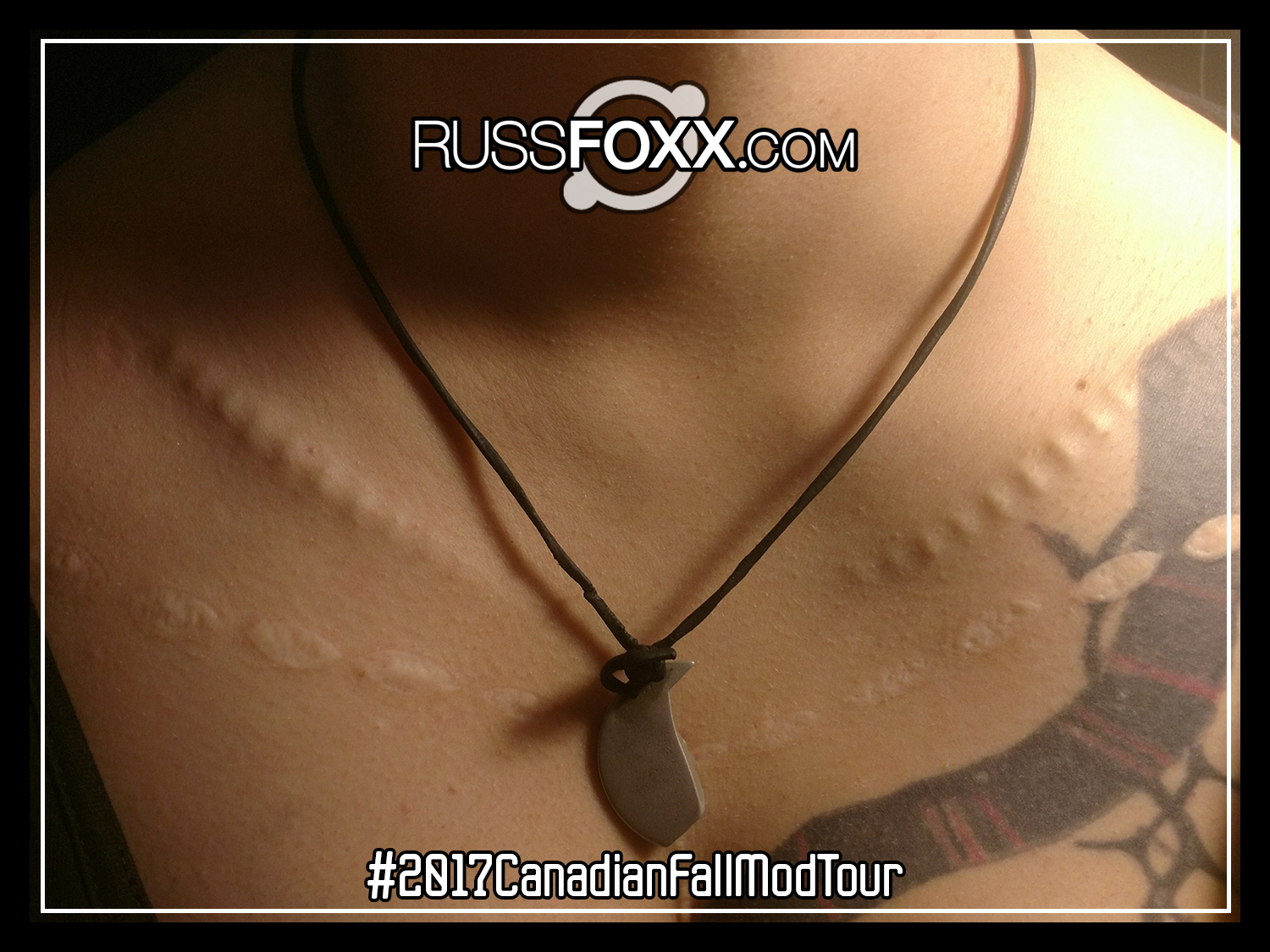 Subdermal Implants Russ Foxx