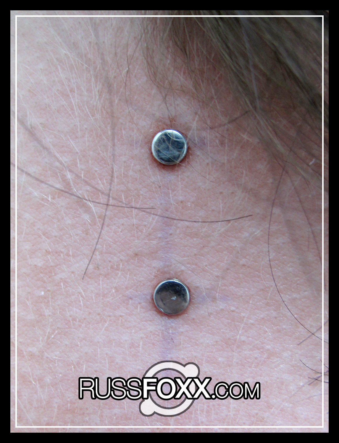 Microdermal Anchors Russ Foxx